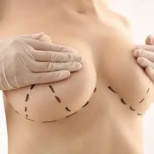 Breast Aesthetics Advanced Breast Surgery