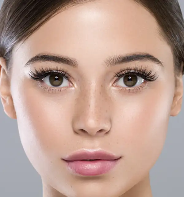 Canthoplasty (Cat Eye) Almond Eye Surgery