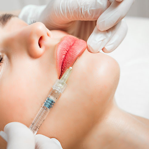 Hyaluronic Acid Lip Filler Augmentation