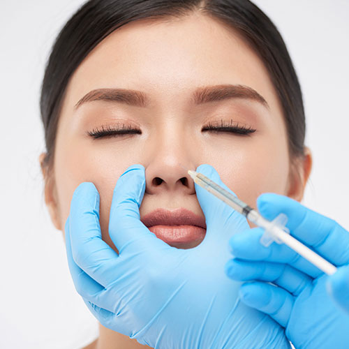 Non-Surgical Rhinoplasty Nose Filler