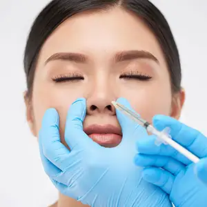 Non-Surgical Rhinoplasty Nose Filler