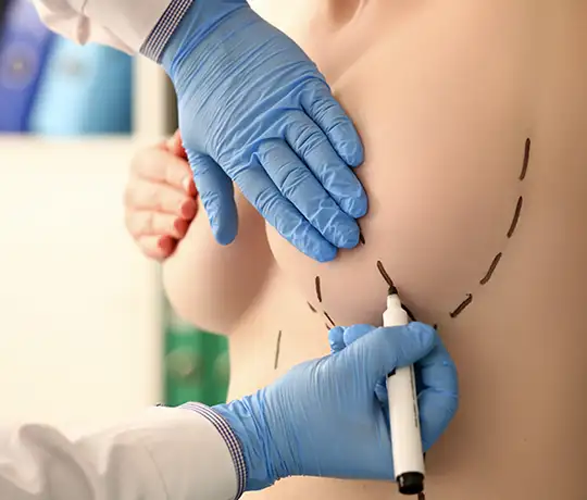 Prof. Dr. Ismail Kucuker Clinic Istanbul Breast Aesthetics Augmentation Reduction and Mastopexy Surgery