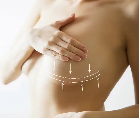 Prof. Dr. Ismail Kucuker Clinic Istanbul Breast Lift Surgery Mastopexy Tightening Treatment